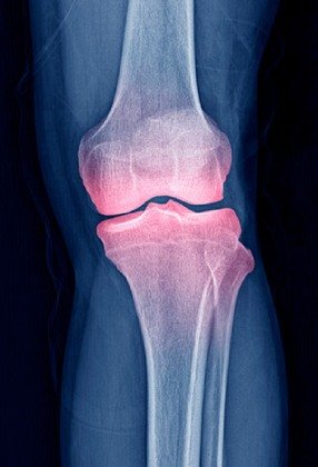 Joint Genesis supports joint lubrication